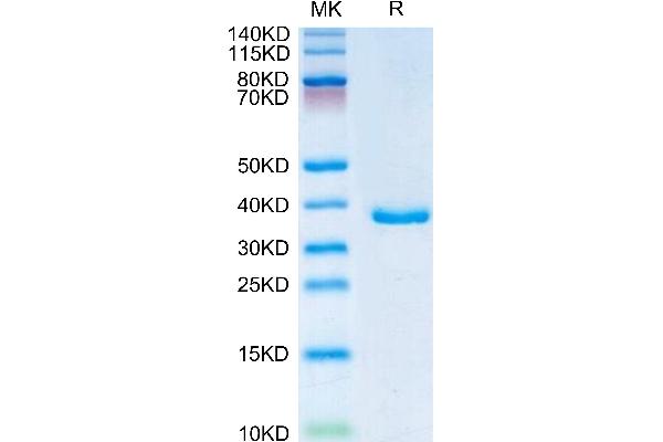 IGFBP2 Protein (AA 36-325) (His tag)