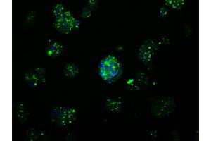 Image no. 7 for anti-Amyloid beta (A4) Precursor Protein (APP) antibody (ABIN1496876) (APP antibody)