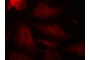 Immunofluorescence staining of methanol-fixed Hela cells using Tau(Phospho-Ser404) Antibody. (MAPT antibody  (pSer404))