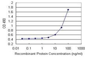 Sandwich ELISA detection sensitivity ranging from 3 ng/mL to 100 ng/mL. (TAGLN (Human) Matched Antibody Pair)