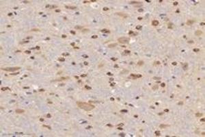 Immunohistochemistry analysis of paraffin-embedded mouse brain using,ABCA7 (ABIN7073146) at dilution of 1: 3000 (ABCA7 antibody)