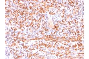 Formalin-fixed, paraffin-embedded human Uterus stained with Calponin-1 Recombinant Mouse Monoclonal Antibody (rCNN1/832). (Recombinant CNN1 antibody)