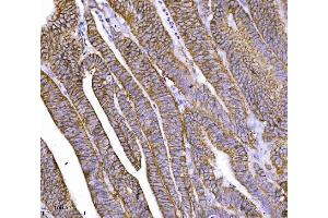 IHC analysis of CTNND1 using anti-CTNND1 antibody (ABIN7602220). (CTNND1 antibody  (AA 64-930))
