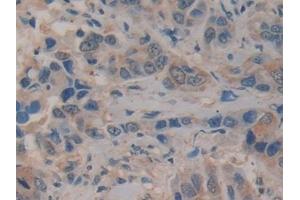 Immunohistochemistry (IHC) image for anti-Kallikrein 10 (KLK10) (AA 35-276) antibody (ABIN7429862)