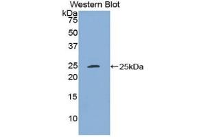 Detection of Recombinant SDF4, Rat using Polyclonal Antibody to Stromal Cell Derived Factor 4 (SDF4) (SDF4 antibody  (AA 184-382))