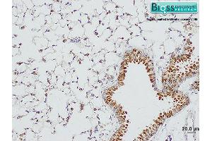 Immunohistochemistry (IHC) image for anti-Surfactant Protein D (SFTPD) (AA 301-375) antibody (ABIN731678)