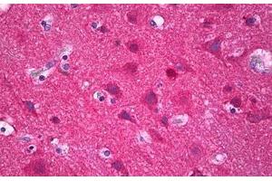 Anti-IRX3 antibody IHC staining of human brain, cortex neurons. (IRX3 antibody  (AA 271-320))