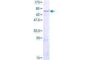 Image no. 1 for PTK6 Protein tyrosine Kinase 6 (PTK6) (AA 1-451) protein (GST tag) (ABIN1316782) (PTK6 Protein (AA 1-451) (GST tag))