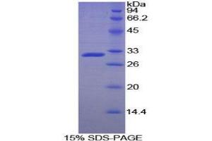 SDS-PAGE (SDS) image for Acid Phosphatase 5, Tartrate Resistant (ACP5) (AA 29-296) protein (His tag) (ABIN1169736) (ACP5 Protein (AA 29-296) (His tag))