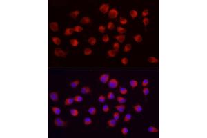Immunofluorescence analysis of Neuro-2a using ENO2 Rabbit mAb (ABIN7266959) at dilution of 1:100 (40x lens). (ENO2/NSE antibody)