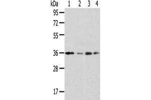 Western Blotting (WB) image for anti-Homeobox D13 (HOXD13) antibody (ABIN5961463) (Homeobox D13 antibody)