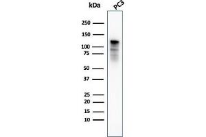 Western Blot Analysis of PC3 cell lysate using Drebrin-1 Mouse Monoclonal Antibody (DBN1/3393). (DBN1 antibody  (AA 150-281))