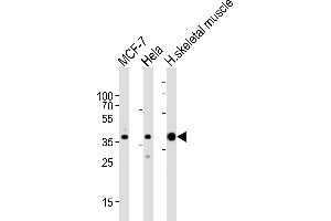 Western blot analysis of lysates from MCF-7, Hela cell line and human skeletal muscle tissue lysate (from left to right), using ALDOA Antibody (C-term) (ABIN389192 and ABIN2839355). (ALDOA antibody  (C-Term))