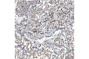 IHC analysis of U1-C/SNRPC using anti-U1-C/SNRPC antibody (ABIN7599016). (SNRPC antibody  (AA 1-159))