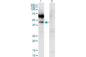Western Blot analysis of CSF2RA expression in transfected 293T cell line by CSF2RA monoclonal antibody (M03), clone 2G5. (CSF2RA antibody  (AA 1-400))