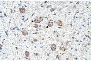 Immunohistochemical staining (Formalin-fixed paraffin-embedded sections) of human brain with KLHL25 polyclonal antibody . (KLHL25 antibody  (AA 163-212))