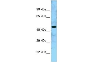 WB Suggested Anti-GTPBP5 Antibody Titration: 1. (GTPBP5 antibody  (N-Term))