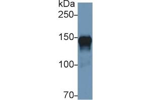 Detection of ORP150 in Human Lung lysate using Polyclonal Antibody to 150 kDa Oxygen Regulated Protein (ORP150) (150 kDa Oxygen Regulated Protein (AA 695-994) antibody)