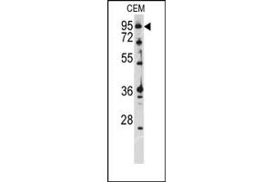 Image no. 1 for anti-Ataxin 1 (ATXN1) antibody (ABIN357975) (Ataxin 1 antibody)