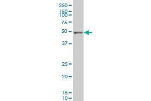 ALDH2 monoclonal antibody (M01), clone 1E5 Western Blot analysis of ALDH2 expression in MCF-7 . (ALDH2 antibody  (AA 408-517))