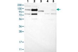 Western blot analysis of Lane 1: RT-4, Lane 2: U-251 MG, Lane 3: Human Plasma, Lane 4: Liver, Lane 5: Tonsil with ZNF592 polyclonal antibody . (ZNF592 antibody)