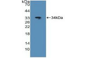 Detection of Recombinant JUN, Human using Polyclonal Antibody to V-Jun Sarcoma Virus 17 Oncogene Homolog (JUN) (C-JUN antibody  (AA 11-262))
