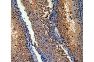 IHC-P analysis of Brain tissue, with DAB staining. (PACAP antibody  (AA 1-175))