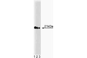 Western blot analysis of Ras on A431 lysate. (RAS antibody  (AA 1-190))
