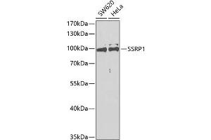 Western blot analysis of extracts of various cell lines, using SSRP1 antibody (ABIN6129536, ABIN6148492, ABIN6148494 and ABIN6217711) at 1:400 dilution. (SSRP1 antibody  (AA 1-300))