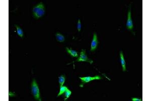 Immunofluorescent analysis of U251 cells using ABIN7145914 at dilution of 1:100 and Alexa Fluor 488-congugated AffiniPure Goat Anti-Rabbit IgG(H+L) (CCR1 antibody  (AA 306-355))