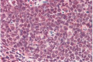 ABIN571263 (5µg/ml) staining of paraffin embedded Human Tonsil. (TMEM205 antibody  (AA 142-151))