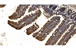 IHC analysis of delta 1 Catenin/CAS/CTNND1 using anti-delta 1 Catenin/CAS/CTNND1 antibody (ABIN7602221). (CTNND1 antibody  (AA 64-930))