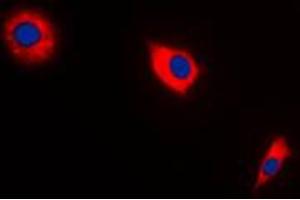 Immunofluorescent analysis of BAX staining in A549 cells. (BAX antibody  (Center))