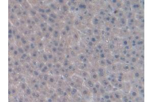 Detection of INHbB in Rat Liver Tissue using Polyclonal Antibody to Inhibin Beta B (INHbB)