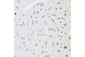 Immunohistochemistry (Paraffin-embedded Sections) (IHC (p)) image for anti-Mitogen-Activated Protein Kinase 3 (MAPK3) (AA 1-100) antibody (ABIN3020725)