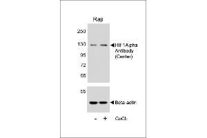 Western Blotting (WB) image for anti-Hypoxia Inducible Factor 1, alpha Subunit (Basic Helix-Loop-Helix Transcription Factor) (HIF1A) (AA 519-547) antibody (ABIN652389)