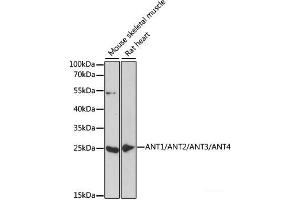 Western blot analysis of extracts of various cell lines using ANT1/ANT2/ANT3/ANT4 Polyclonal Antibody at dilution of 1:1000. (ANT1+ANT2+ANT3+ANT4 antibody)