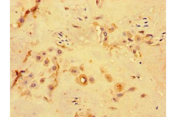 PKD1L3 antibody  (AA 22-194)