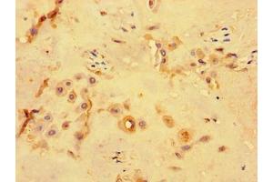 Immunohistochemistry of paraffin-embedded human placenta tissue using ABIN7163828 at dilution of 1:100 (PKD1L3 antibody  (AA 22-194))