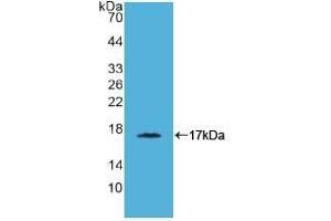 Detection of Recombinant CD40L, Simian using Polyclonal Antibody to Cluster Of Differentiation 40 Ligand (CD40L) (CD40 Ligand antibody  (AA 180-261))
