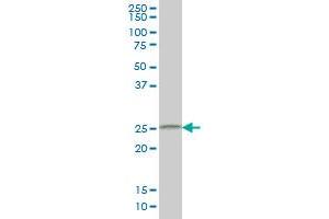 Western Blotting (WB) image for anti-Cell Death-Inducing DFFA-Like Effector B (CIDEB) (AA 3-111) antibody (ABIN599215) (CIDEB antibody  (AA 3-111))