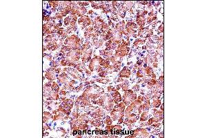 P28 Antibody (Center) (ABIN657656 and ABIN2846650) iunohistochemistry analysis in formalin fixed and paraffin embedded human pancreas tissue followed by peroxidase conjugation of the secondary antibody and DAB staining. (MMP28 antibody  (AA 195-223))