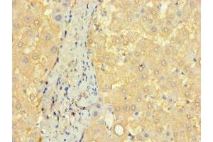 Immunohistochemistry of paraffin-embedded human liver tissue using ABIN7148140 at dilution of 1:100 (CCDC68 antibody  (AA 131-335))
