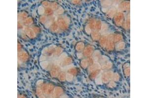 Figure. (GGH antibody  (AA 25-318))
