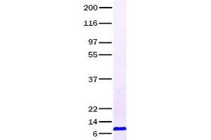 Validation with Western Blot (PF4 Protein)