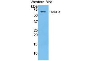 Detection of Recombinant Albumin, Rat using Polyclonal Antibody to Albumin (ALB) (Albumin antibody)