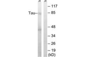Western blot analysis of extracts from Jurkat cells, using Tau (Ab-519/202) Antibody. (tau antibody  (AA 266-315))