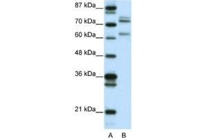 Western Blotting (WB) image for anti-GATA Zinc Finger Domain Containing 2B (GATAD2B) antibody (ABIN2460620) (GATAD2B antibody)