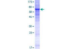 ENTPD8 Protein (AA 1-458) (GST tag)