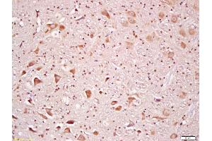 Formalin-fixed and paraffin embedded rat brain labeled with Anti-Rsk2 Polyclonal Antibody, Unconjugated (ABIN700720) at 1:200 followed by conjugation to the secondary antibody and DAB staining (RPS6KA3 antibody  (AA 56-160))